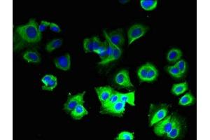 Immunofluorescent analysis of MCF-7 cells using ABIN7149171 at dilution of 1:100 and Alexa Fluor 488-congugated AffiniPure Goat Anti-Rabbit IgG(H+L) (COX5B antibody  (AA 32-129))