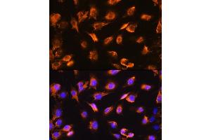 Immunofluorescence analysis of C6 cells using alpha Sarcoglycan (alpha Sarcoglycan (SGCA)) Rabbit pAb (ABIN1682687, ABIN5664644, ABIN5664646 and ABIN6220497) at dilution of 1:100. (SGCA antibody  (AA 60-290))