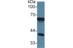 Detection of AFP in Mouse Cerebrum lysate using Polyclonal Antibody to Alpha-Fetoprotein (AFP) (alpha Fetoprotein antibody  (AA 409-611))