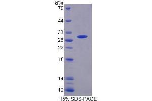 SDS-PAGE (SDS) image for Hepcidin Antimicrobial Peptide (HAMP) (AA 25-84) protein (His tag) (ABIN1099156)