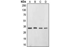 Western blot analysis of CD326 expression in A431 (A), SW480 (B), HepG2 (C), Caco2 (D) whole cell lysates. (EpCAM antibody  (Center))
