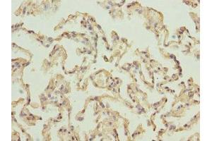 Immunohistochemistry of paraffin-embedded human lung tissue using ABIN7142727 at dilution of 1:100 (RPLP2 antibody  (AA 1-115))