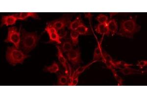 ABIN6275704 staining HuvEc by IF/ICC. (ZADH2 antibody  (Internal Region))