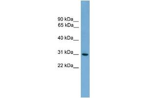 WB Suggested Anti-HLA-DQA2  Antibody Titration: 0. (HLA-DQA2 antibody  (N-Term))