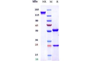 Anti-FGFR4 / CD334 Reference Antibody (U3-1784) on SDS-PAGE under reducing (R) condition.