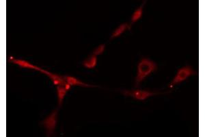 ABIN6274898 staining Hela cells by IF/ICC. (BNIP2 antibody  (Internal Region))