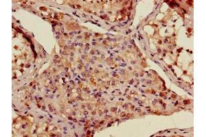 Immunohistochemistry of paraffin-embedded human testis tissue using ABIN7142874 at dilution of 1:100 (ADAMTS12 antibody  (AA 26-229))