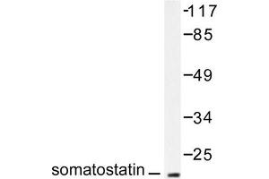 Image no. 2 for anti-Somatostatin (SST) antibody (ABIN271820) (Somatostatin antibody)