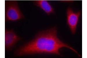 Image no. 2 for anti-Protein Kinase D1 (PRKD1) (pSer910) antibody (ABIN196784) (PKC mu antibody  (pSer910))