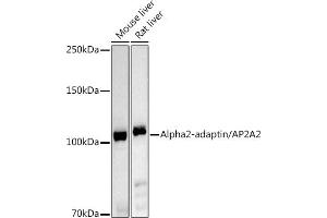 Western blot analysis of extracts of various cell lines, using Alph-adaptin/ antibody (ABIN6130980, ABIN6136955, ABIN6136957 and ABIN6221039) at 1:1000 dilution. (AP2A2 antibody  (AA 590-939))