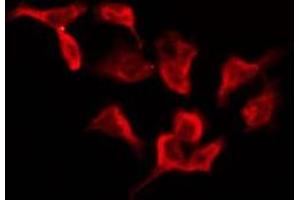 ABIN6276153 staining Hela by IF/ICC. (OR4D1 antibody  (C-Term))