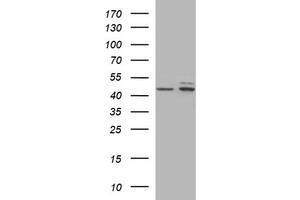 Image no. 1 for anti-Tubulin, beta 2B (TUBB2B) antibody (ABIN1501574)