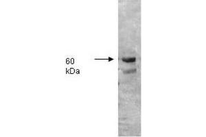 Image no. 2 for anti-Intestinal Alkaline Phosphatase (ALPI) antibody (ABIN303053) (Intestinal Alkaline Phosphatase antibody)