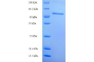 SDS-PAGE (SDS) image for Retinol Dehydrogenase 12 (All-Trans/9-Cis/11-Cis) (RDH12) (AA 1-316), (full length) protein (His-SUMO Tag) (ABIN5711610) (RDH12 Protein (AA 1-316, full length) (His-SUMO Tag))