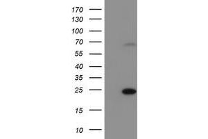 HEK293T cells were transfected with the pCMV6-ENTRY control (Left lane) or pCMV6-ENTRY C6orf64 (Right lane) cDNA for 48 hrs and lysed. (SAYSD1 antibody)