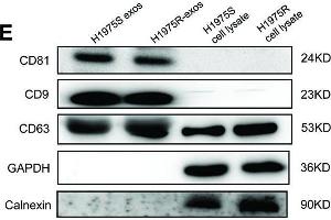 Establishment of osimertinib-resistant H1975 cell lines. (CD63 antibody)