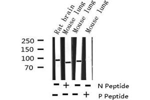 Western blot analysis of Phospho-p95/NBS1 (Ser343) expression in various lysates (Nibrin antibody  (pSer343))