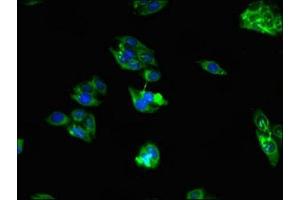 Immunofluorescent analysis of HepG2 cells using ABIN7167318 at dilution of 1:100 and Alexa Fluor 488-congugated AffiniPure Goat Anti-Rabbit IgG(H+L) (RAB39B antibody  (AA 1-213))