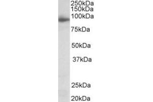 Western Blotting (WB) image for anti-Neuroligin 4 (NLGN4) (Internal Region) antibody (ABIN2465126)