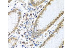 Immunohistochemistry of paraffin-embedded Human stomach using EIF4E Polyclonal Antibody at dilution of 1:100 (40x lens). (EIF4E antibody)
