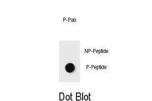 Dot blot analysis of Phospho-mouse JUN- Antibody Phospho-specific Pab (ABIN1539781 and ABIN2850536) on nitrocellulose membrane. (C-JUN antibody  (pThr289))