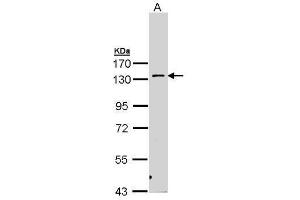WB Image Sample (30 ug of whole cell lysate) A: H1299 7. (PKN2 antibody)