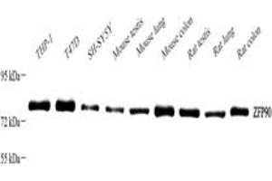 Western blot analysis of ZFP90 ABIN7076275),at dilution of 1: 2000,Lane 1: THP-1 cell lysate,Lane 2: T47D cell lysate,Lane 3: SH-SY5Y cell lysate,Lane 4: Mouse testis tissue lysate,Lane 5: Mouse lung tissue lysate,Lane 6: Mouse colon tissue lysate,Lane 7: Rat testis tissue lysate,Lane 8: Rat lung tissue lysate,Lane 9: Rat colon tissue lysate (ZNF90 antibody)