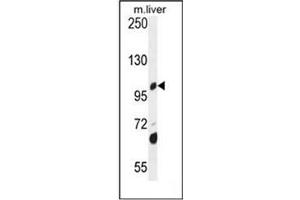Western blot analysis of DHTKD1 Antibody  in mouse liver tissue lysates (35ug/lane). (DHTKD1 antibody  (Middle Region))