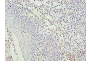 Immunohistochemistry of paraffin-embedded human tonsil tissue using ABIN7149090 at dilution of 1:100 (CYBC1 (AA 43-187) antibody)