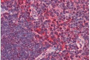 Human Thymus (formalin-fixed, paraffin-embedded) stained with CXCR6 antibody ABIN351436 at 2. (CXCR6 antibody  (N-Term))