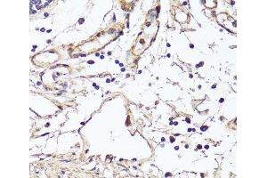 Immunohistochemistry of paraffin-embedded Human colon using VEGF Monoclonal Antibody at dilution of 1:150 (40x lens).