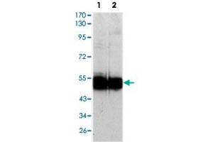 Western blot analysis using VCAM1 monoclonal antobody, clone 6G9  against HUVEC (1) and EC (2) cell lysate.