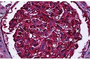 Human Kidney, Glomeruli: Formalin-Fixed, Paraffin-Embedded (FFPE) (Myosin 9 antibody)