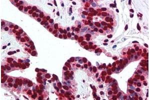 Human Breast (formalin-fixed, paraffin-embedded) stained with Histone H2A antibody ABIN291582 at 5 ug/ml followed by biotinylated goat anti-rabbit IgG secondary antibody ABIN481713, alkaline phosphatase-streptavidin and chromogen. (Histone H2A antibody  (AA 1-15))