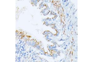 Immunohistochemistry of paraffin-embedded rat lung using IL3RA antibody (ABIN1680453, ABIN3018298, ABIN3018299, ABIN5664529 and ABIN6220429) at dilution of 1:100 (40x lens). (IL3RA antibody  (AA 1-100))