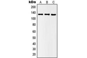 Western blot analysis of Histone Deacetylase 5 (pS498) expression in HEK293T LPS-treated (A), Raw264. (HDAC5 antibody  (pSer498))