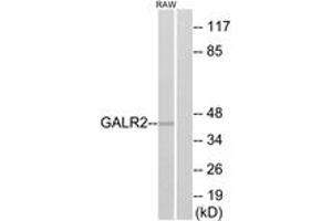 Western blot analysis of extracts from RAW264. (GALR2 antibody  (AA 201-250))