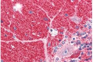 Human Brain, Cerebellum (formalin-fixed, paraffin-embedded) stained with DISC1 antibody ABIN351527 at 5 ug/ml followed by biotinylated goat anti-rabbit IgG secondary antibody ABIN481713, alkaline phosphatase-streptavidin and chromogen. (DISC1 antibody  (C-Term))
