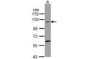 WB Image Sample(30 ug whole cell lysate) A:A431, 7. (UBA7 antibody  (N-Term))