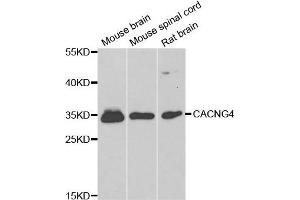 Western blot analysis of extracts of various cell lines, using CACNG4 antibody. (CACNG4 antibody)