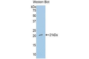 Western Blotting (WB) image for anti-Nitric Oxide Synthase 1, Neuronal (NOS1) (AA 726-894) antibody (ABIN1860024) (NOS1 antibody  (AA 726-894))