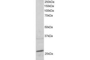 Image no. 1 for anti-RAB11A, Member RAS Oncogene Family (RAB11A) (C-Term) antibody (ABIN374252) (RAB11A antibody  (C-Term))