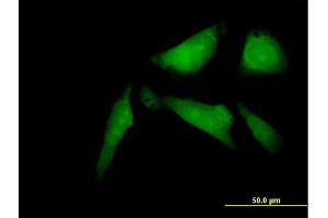 Immunofluorescence of purified MaxPab antibody to SSX2IP on HeLa cell. (SSX2IP antibody  (AA 1-614))
