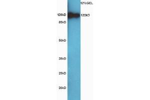 Lane 1: Huh7 probed with Rabbit Anti-CD44 Polyclonal Antibody, Unconjugated (ABIN669591) at 1:300 overnight at 4 °C. (CD44 antibody  (AA 701-742))