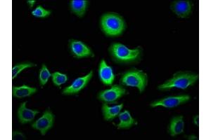 Immunofluorescence staining of A549 cells with ABIN7145194 at 1:66, counter-stained with DAPI. (NAIP antibody  (AA 147-242))