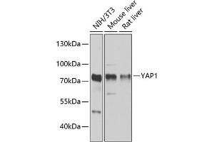 Western blot analysis of extracts of various cell lines, using Y antibody (ABIN6132789, ABIN6150317, ABIN6150322 and ABIN6215136) at 1:1000 dilution. (YAP1 antibody  (AA 155-504))