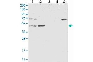 Western blot analysis of Lane 1: RT-4, Lane 2: U-251 MG, Lane 3: Human Plasma, Lane 4: Liver, Lane 5: Tonsil with NT5DC1 polyclonal antibody .