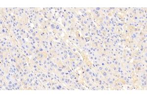 Immunohistochemistry (IHC) image for anti-alpha-2-Macroglobulin (A2M) (AA 616-856) antibody (ABIN7429073)