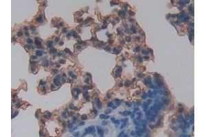 #VALUE! (RAGE antibody  (AA 10-188))