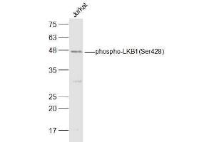 Jurkat lysates probed with LKB1(Ser428) Polyclonal Antibody, Unconjugated  at 1:500 dilution and 4˚C overnight incubation. (LKB1 antibody  (pSer428))